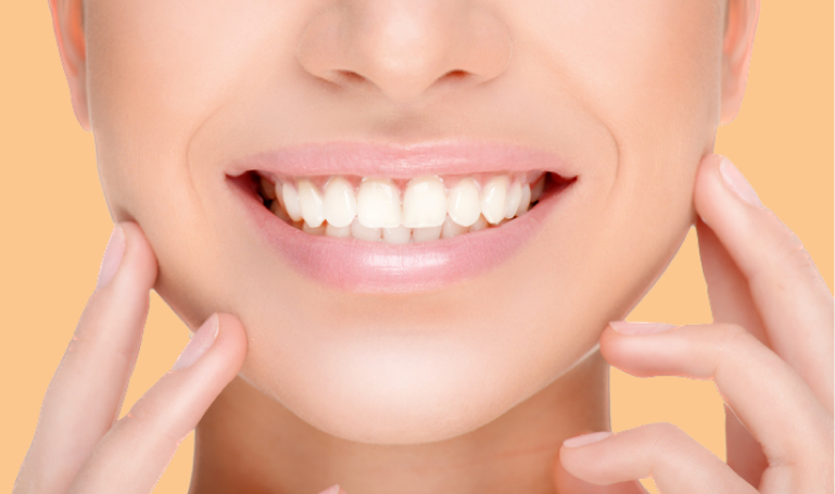 home-teeth-whitening